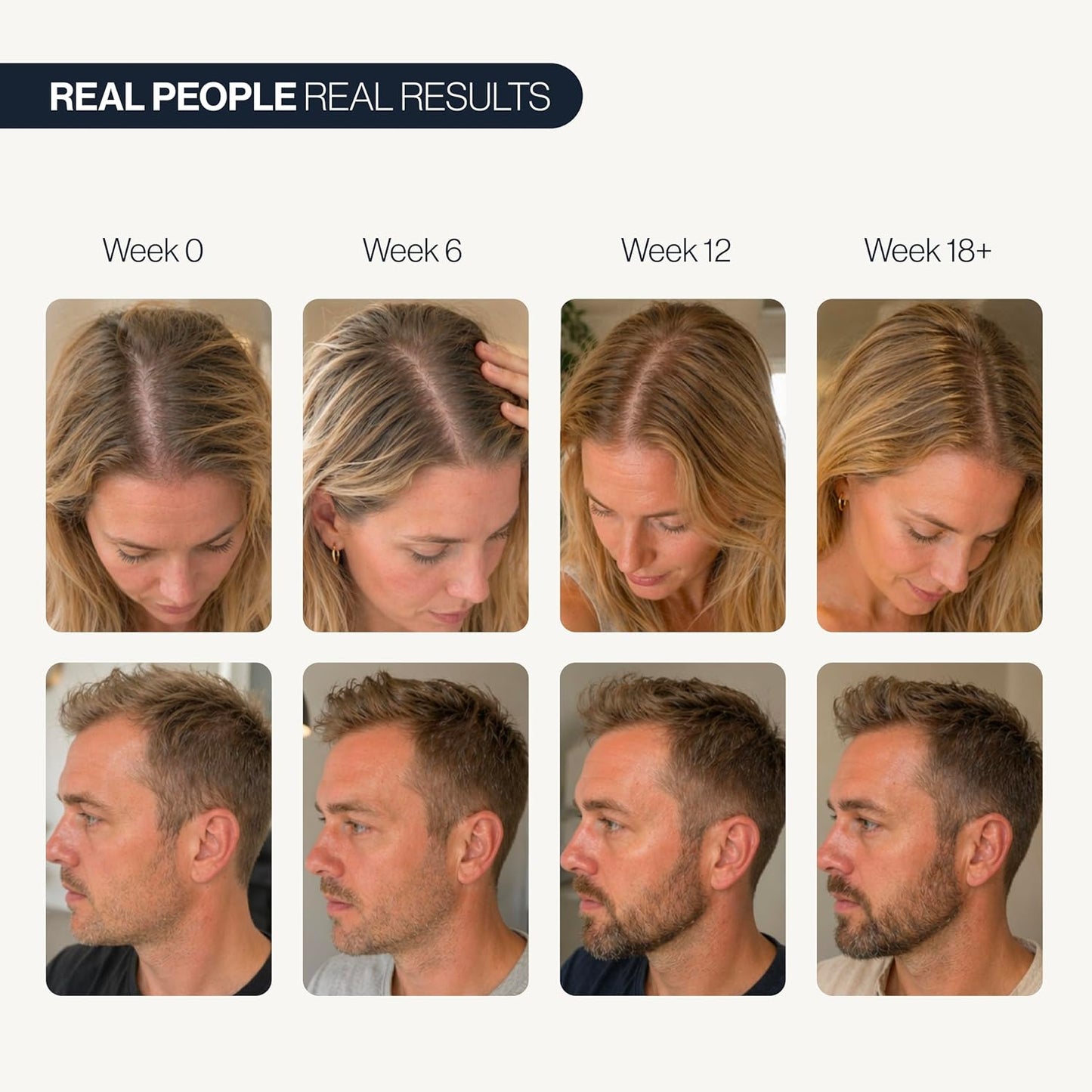 Advanced Hair Growth Serum