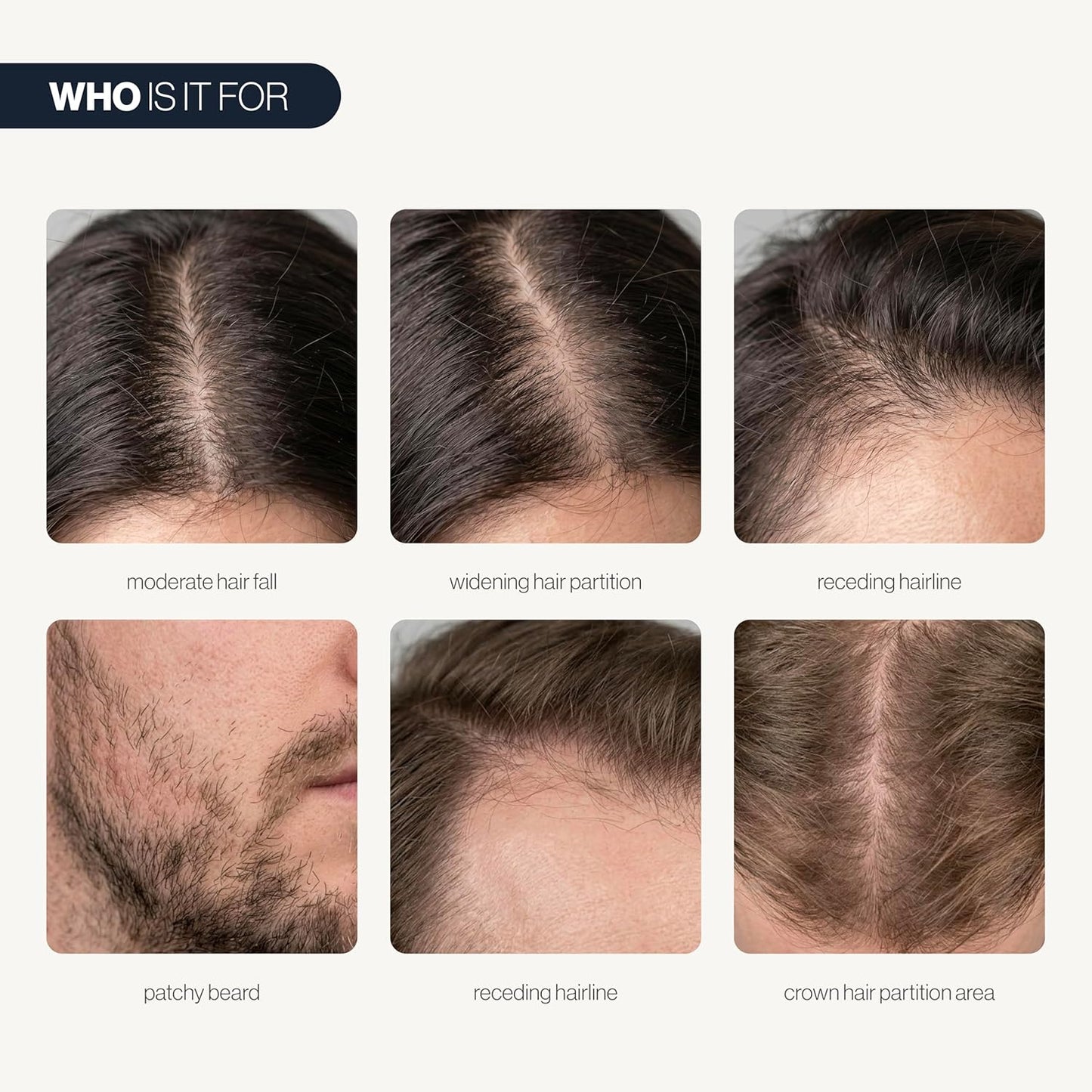 Advanced Hair Growth Serum