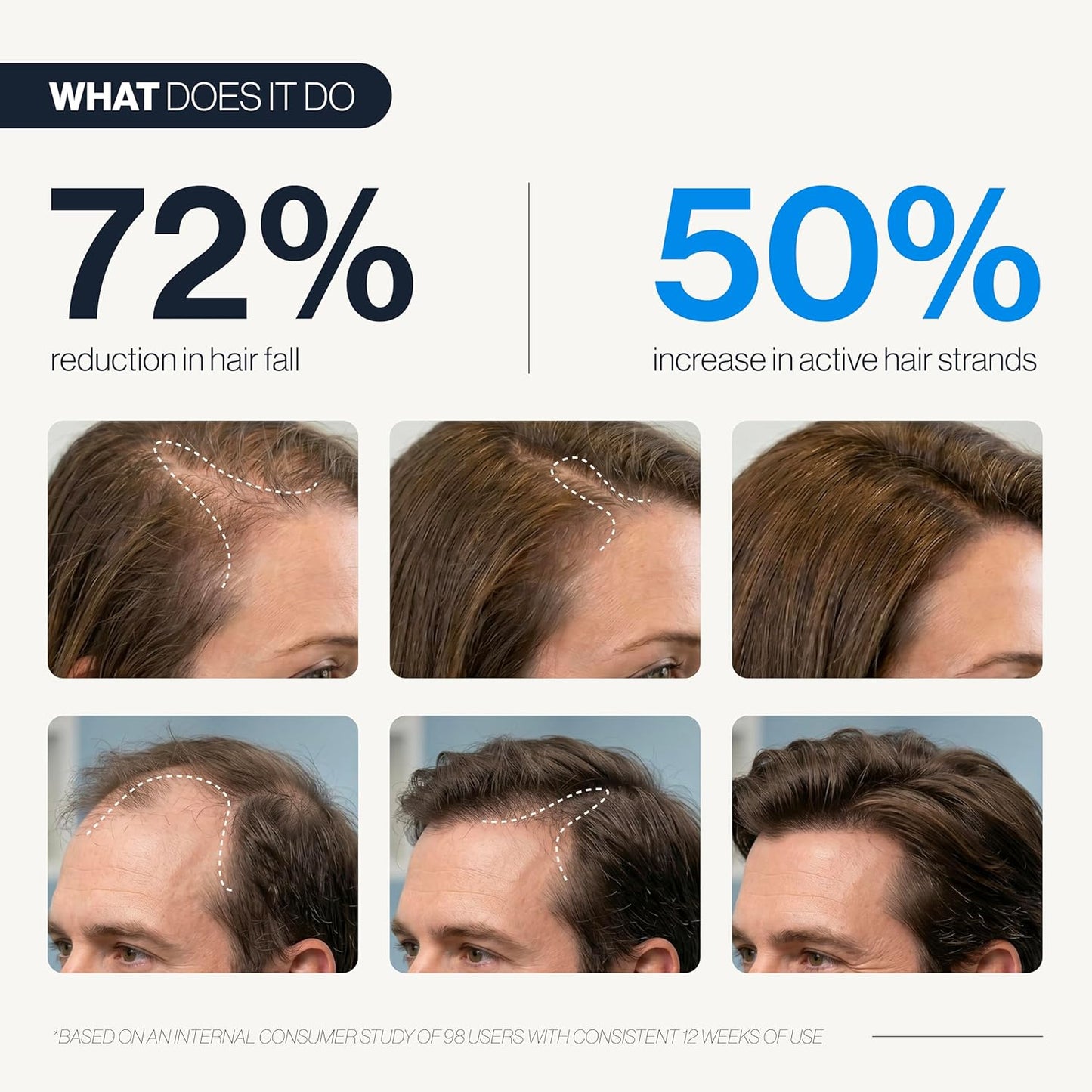 Advanced Hair Growth Serum